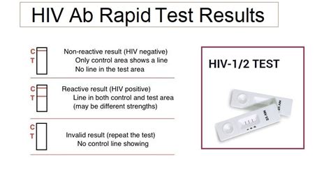 how to read std results|Understanding Your HIV Test Results .